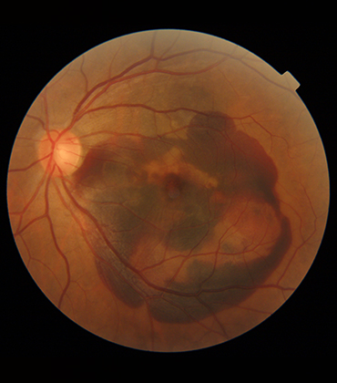 ., Topcon Healthcare | Med Tech Business Review | Eye Care Diagnostic Solutions